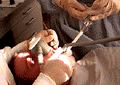 at the dentist, 1996